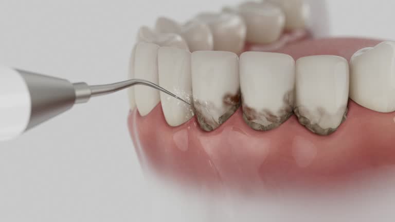 Reliable Dental contractor in Roosevelt, NJ by Smile Center Dentistry